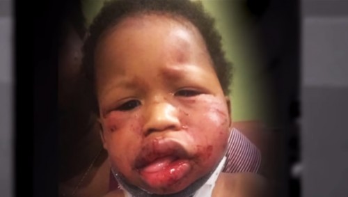 1-Year Old Baby Brutally Attacked at Daycare Center ...